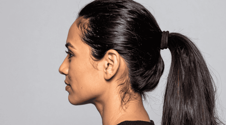Uno de los efectos más comunes de amarrarse el cabello a diario es el debilitamiento de la fibra capilar. CANVA