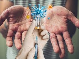 La vacunación contra el sarampión es la principal medida de prevención. ESPECIAL / CANVA