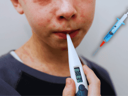 El brote más relevante de sarampión en México se concentra actualmente en Jalisco y Chiapas, aunque también se registran casos en Michoacán y Guerrero. ESPECIAL / CANVA