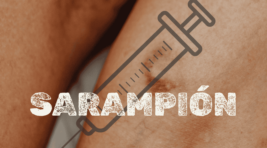 El estado que encabeza la lista de contagios de sarampión en todo México es Chihuahua, con 4 mil 495 casos. ESPECIAL