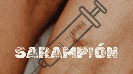 El estado que encabeza la lista de contagios de sarampión en todo México es Chihuahua, con 4 mil 495 casos. ESPECIAL