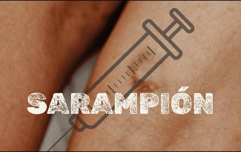 El estado que encabeza la lista de contagios de sarampión en todo México es Chihuahua, con 4 mil 495 casos. ESPECIAL