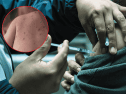 Actualmente, 26 personas se encuentran hospitalizadas a causa del sarampión. EL INFORMADOR/A. Navarro ESPECIAL/Gobierno de México