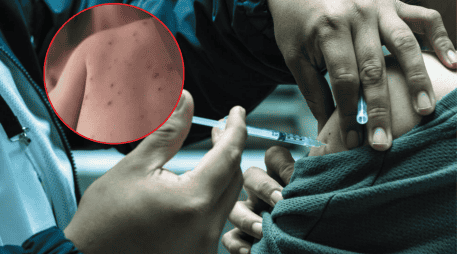 Actualmente, 26 personas se encuentran hospitalizadas a causa del sarampión. EL INFORMADOR/A. Navarro ESPECIAL/Gobierno de México