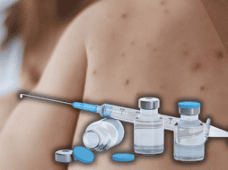 Las autoridades buscan aplicar 1.3 millones de vacunas en un periodo de 45 días para contener el brote de sarampión. ESPECIAL/Gobierno de México/Canva