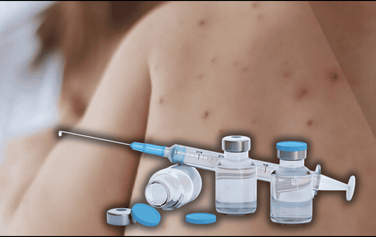 Las autoridades buscan aplicar 1.3 millones de vacunas en un periodo de 45 días para contener el brote de sarampión. ESPECIAL/Gobierno de México/Canva