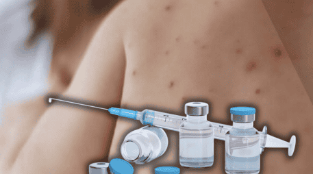 Las autoridades buscan aplicar 1.3 millones de vacunas en un periodo de 45 días para contener el brote de sarampión. ESPECIAL/Gobierno de México/Canva