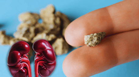 Desde luego, expulsar esas 