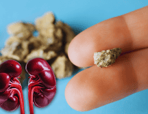 Desde luego, expulsar esas 