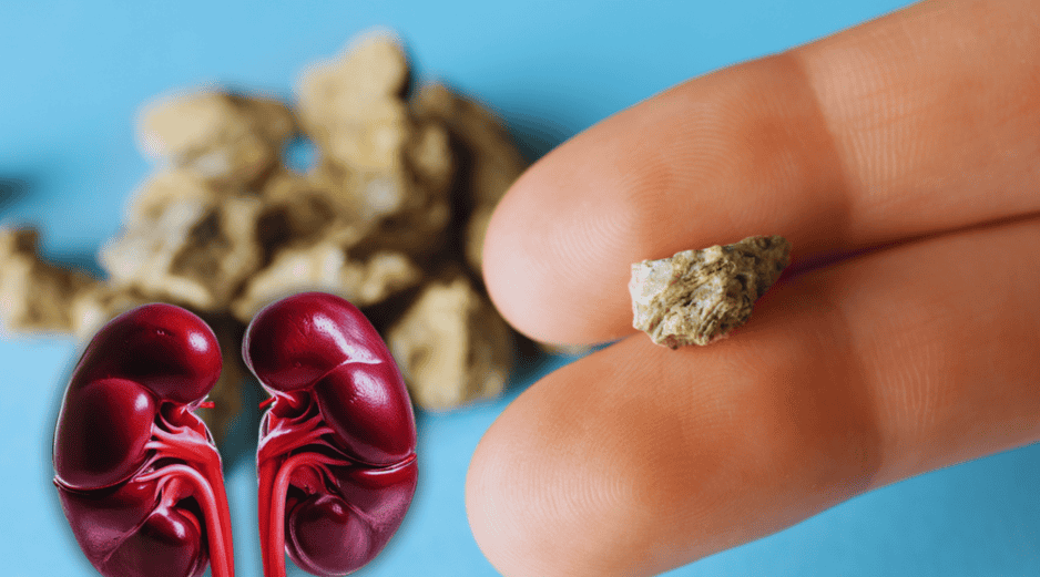 Desde luego, expulsar esas 