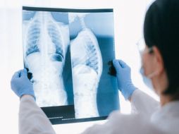 Se trata de Amivantab y Lazertinib, combinación de medicamentos ya disponible en México, que podría ser utilizado por la gran mayoría de pacientes con este tipo de cáncer como sustituto a la quimioterapia. Pexels