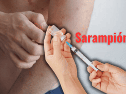 Especialistas de la Universidad Autónoma Metropolitana (UAM) externaron su preocupación ante el brote de sarampión en México. ESPECIAL/Canva