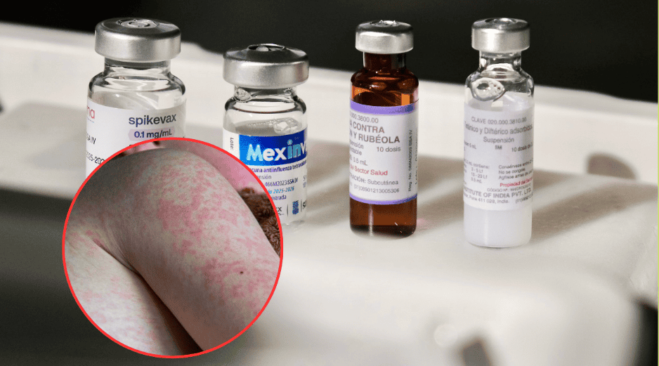 Jalisco ocupa actualmente el segundo lugar a nivel nacional en casos de sarampión registrados este año. ESPECIAL/Gobierno de Jalisco/Canva