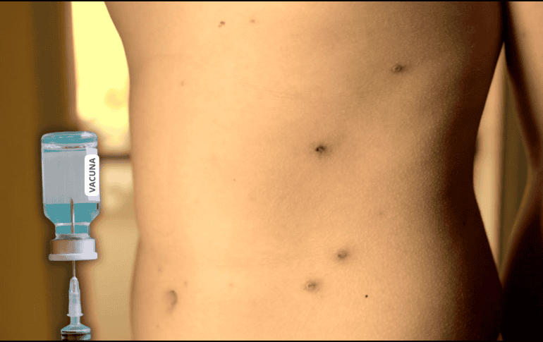 La recomendación general es que la población debe recibir un refuerzo adicional contra el sarampión, sin importar si se trata de menores de edad o personas adultas. ESPECIAL / CANVA