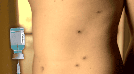 La recomendación general es que la población debe recibir un refuerzo adicional contra el sarampión, sin importar si se trata de menores de edad o personas adultas. ESPECIAL / CANVA