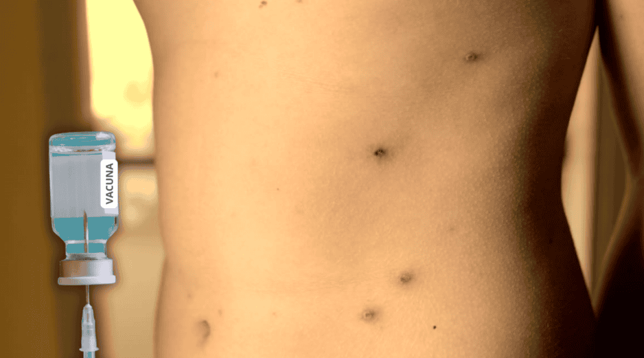 La recomendación general es que la población debe recibir un refuerzo adicional contra el sarampión, sin importar si se trata de menores de edad o personas adultas. ESPECIAL / CANVA