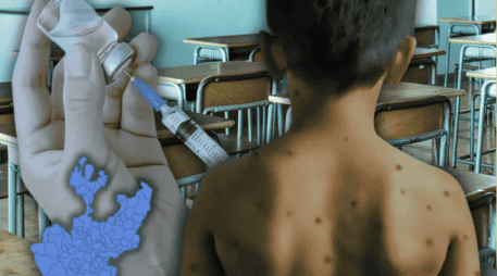Hasta el jueves de la semana pasada, eran 30 las escuelas afectadas por sarampión en Jalisco. ESPECIAL