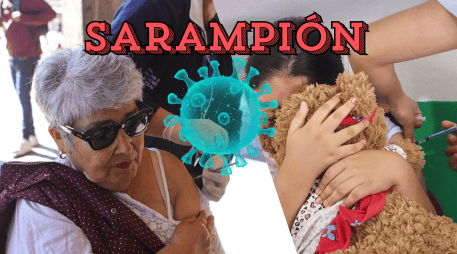 Es importante estar atento ante cualquier sospecha de sarampión y acudir al centro de salud más cercano. EL INFORMADOR / ARCHIVO