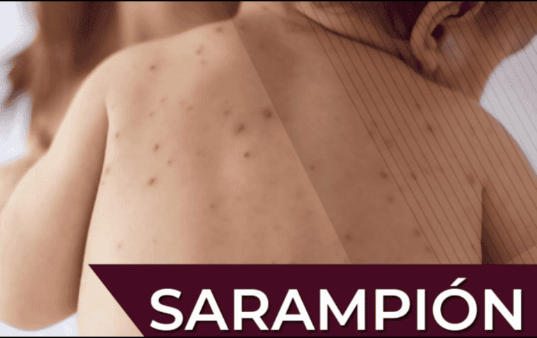 Las autoridades invitan a la población a acudir al  Centro de Salud o módulo de vacunación más cercano para recibir la vacuna contra el sarampión. Gobierno de México