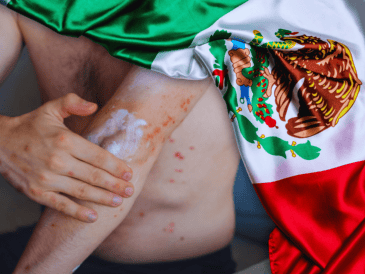 De acuerdo con cifras oficiales, entre 2025 y 2026 se han registrado 9 mil 74 casos acumulados de sarampión en México. ESPECIAL / CANVA