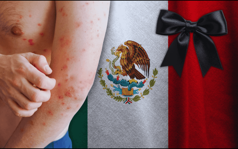 El número oficial de decesos confirmados por sarampión es de 28, con un caso adicional en proceso de dictaminación, que podría elevar la cifra a 29. ESPECIAL / CANVA