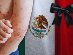 El número oficial de decesos confirmados por sarampión es de 28, con un caso adicional en proceso de dictaminación, que podría elevar la cifra a 29. ESPECIAL / CANVA