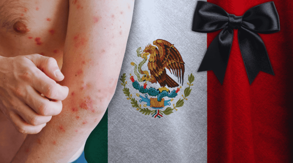 El número oficial de decesos confirmados por sarampión es de 28, con un caso adicional en proceso de dictaminación, que podría elevar la cifra a 29. ESPECIAL / CANVA