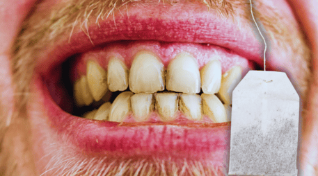 La preparación del té depende de los gustos de cada persona, pero algunas formas pueden causar problemas a los dientes. ESPECIAL / CANVA