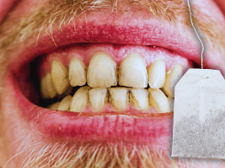 La preparación del té depende de los gustos de cada persona, pero algunas formas pueden causar problemas a los dientes. ESPECIAL / CANVA