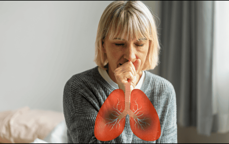 Tan solo en la semana comprendida del 25 al 31 de enero se reportaron 334 nuevos contagios. En comparación, durante el mismo periodo de 2025 se habían contabilizado mil 151 casos acumulados. CANVA