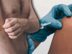 La aplicación de la vacuna contra el sarampión es segura y los efectos secundarios posteriores a su aplicación son mínimos. ESPECIAL/Canva