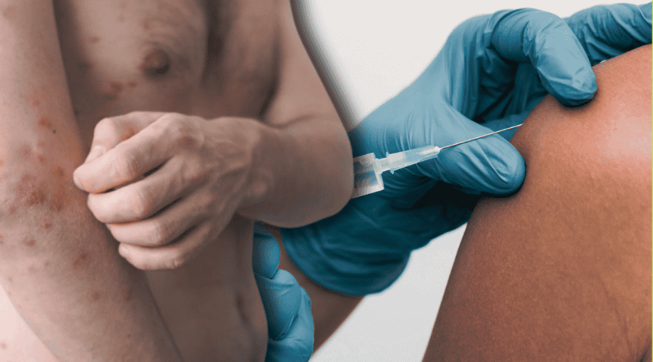 La aplicación de la vacuna contra el sarampión es segura y los efectos secundarios posteriores a su aplicación son mínimos. ESPECIAL/Canva