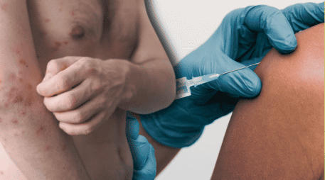 La aplicación de la vacuna contra el sarampión es segura y los efectos secundarios posteriores a su aplicación son mínimos. ESPECIAL/Canva