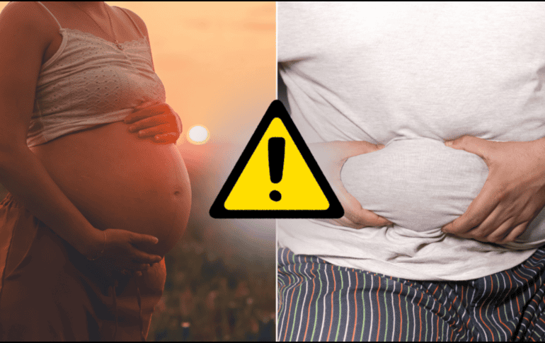 El sobrepeso y la obesidad se asociaron de forma independiente con un mayor riesgo de que los hijos acabaran sufriendo MASLD. CANVA/ESPECIAL