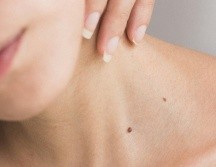 La aplicación de tratamientos naturales puede complementar la rutina de cuidado diario. A. ECHEVERRY