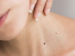 La aplicación de tratamientos naturales puede complementar la rutina de cuidado diario. A. ECHEVERRY