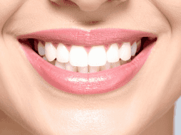 Vómito, diarrea, distensión gástrica o irritaciones de las mucosas son sólo algunas de las consecuencias que puede causar el agua oxigenada o bicarbonato de sodio si se utiliza para blanquear los dientes. CANVA