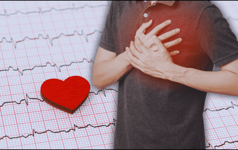 La gestión del estrés también desempeña un papel importante en la prevención de un evento vascular cerebral. ESPECIAL / CANVA