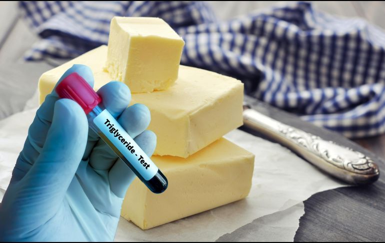 El diagnóstico de los niveles altos de triglicéridos se realiza a través de una prueba de sangre que también evalúa los niveles de colesterol. ESPECIAL / CANVA