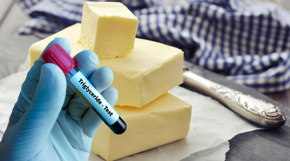 El diagnóstico de los niveles altos de triglicéridos se realiza a través de una prueba de sangre que también evalúa los niveles de colesterol. ESPECIAL / CANVA
