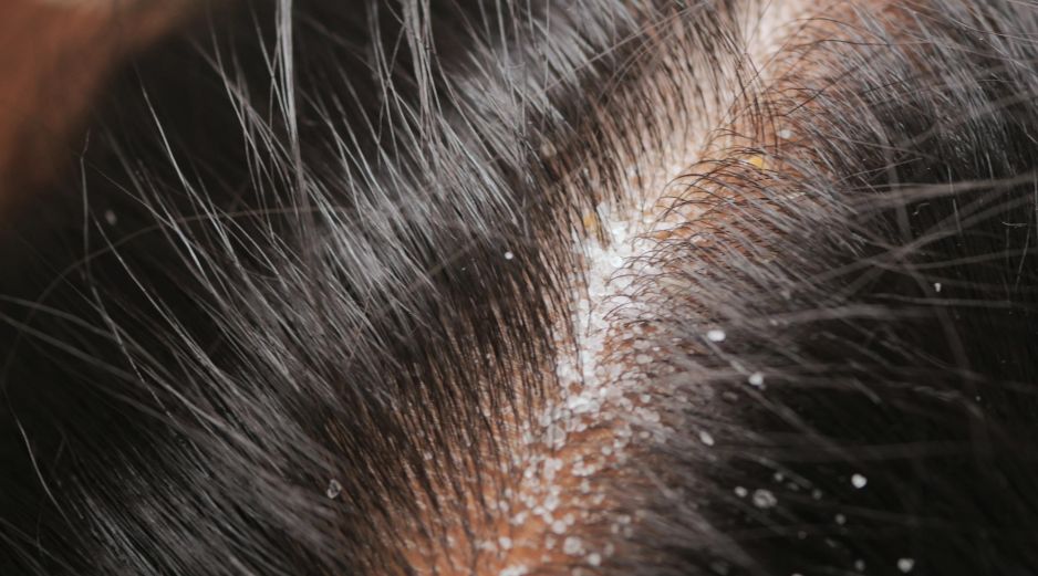 Es importante leer el contenido del medicamento para saber qué ingredientes tiene y preguntarle al médico acerca de cómo pueden interactuar las medicinas con el alcohol. ESPECIAL / CANVA