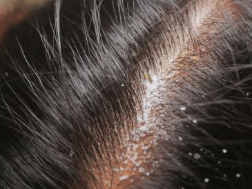 Es importante leer el contenido del medicamento para saber qué ingredientes tiene y preguntarle al médico acerca de cómo pueden interactuar las medicinas con el alcohol. ESPECIAL / CANVA